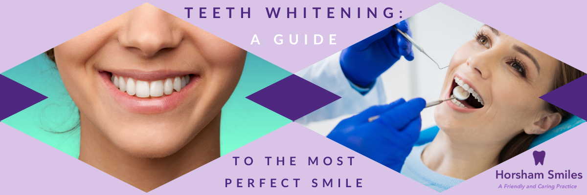 Teeth Whitening: A Guide to the Most Perfect Smile